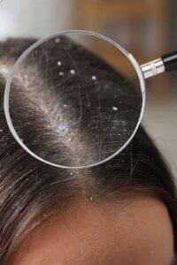 Skincare para cour cabeludo, porque é importante?